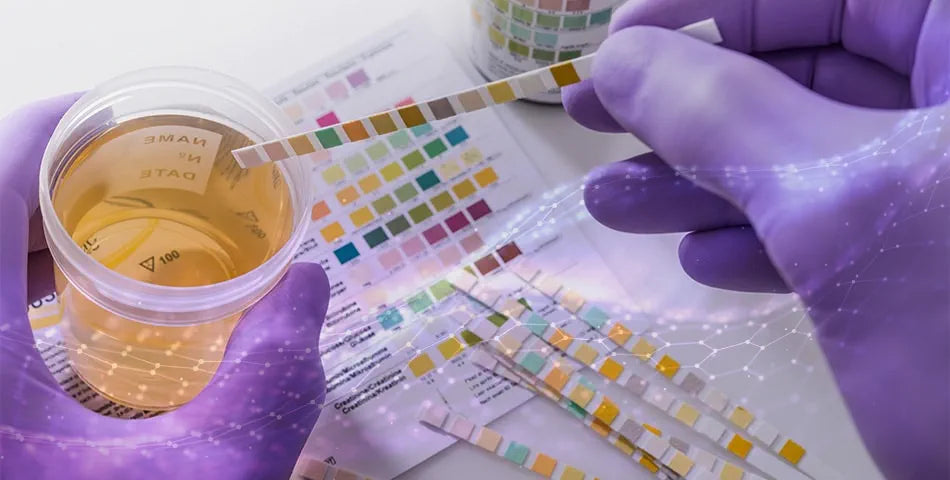 The Hidden Cost of Misdiagnosis: Why Accurate UTI Testing Matters