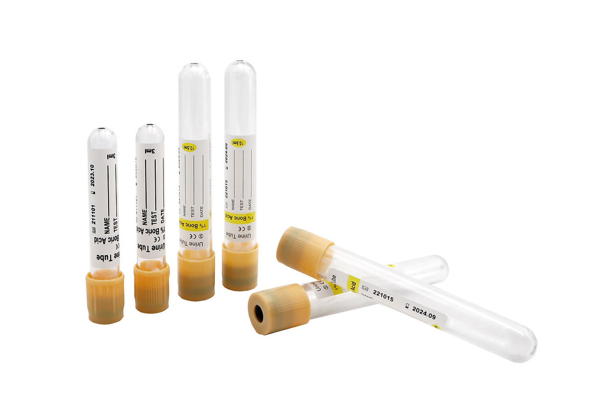 Vacuum Urine Tube | The Labs Choice Vacuum Urine Tube is designed for secure, efficient urine specimen collection and transport. | Labs Choice