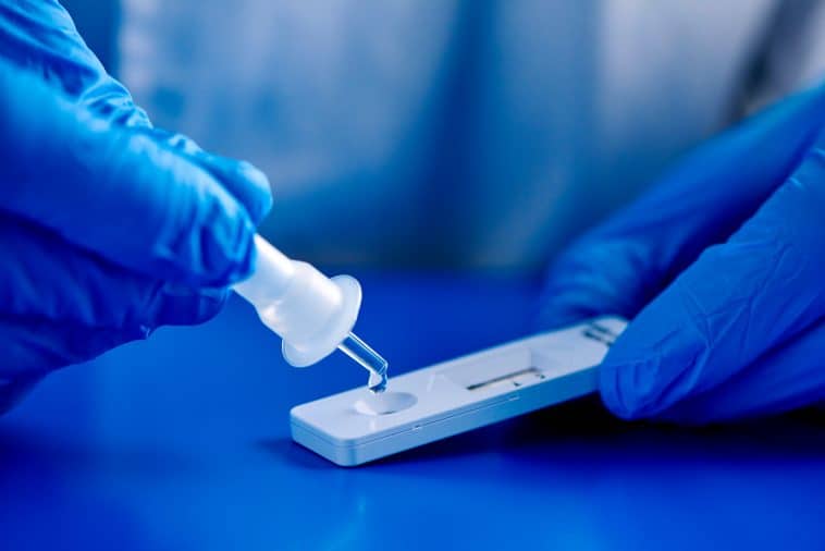 A close-up of a person wearing blue gloves using a small white pipette to transfer test specimen into a white test strip on a blue surface. | Labs Choice
