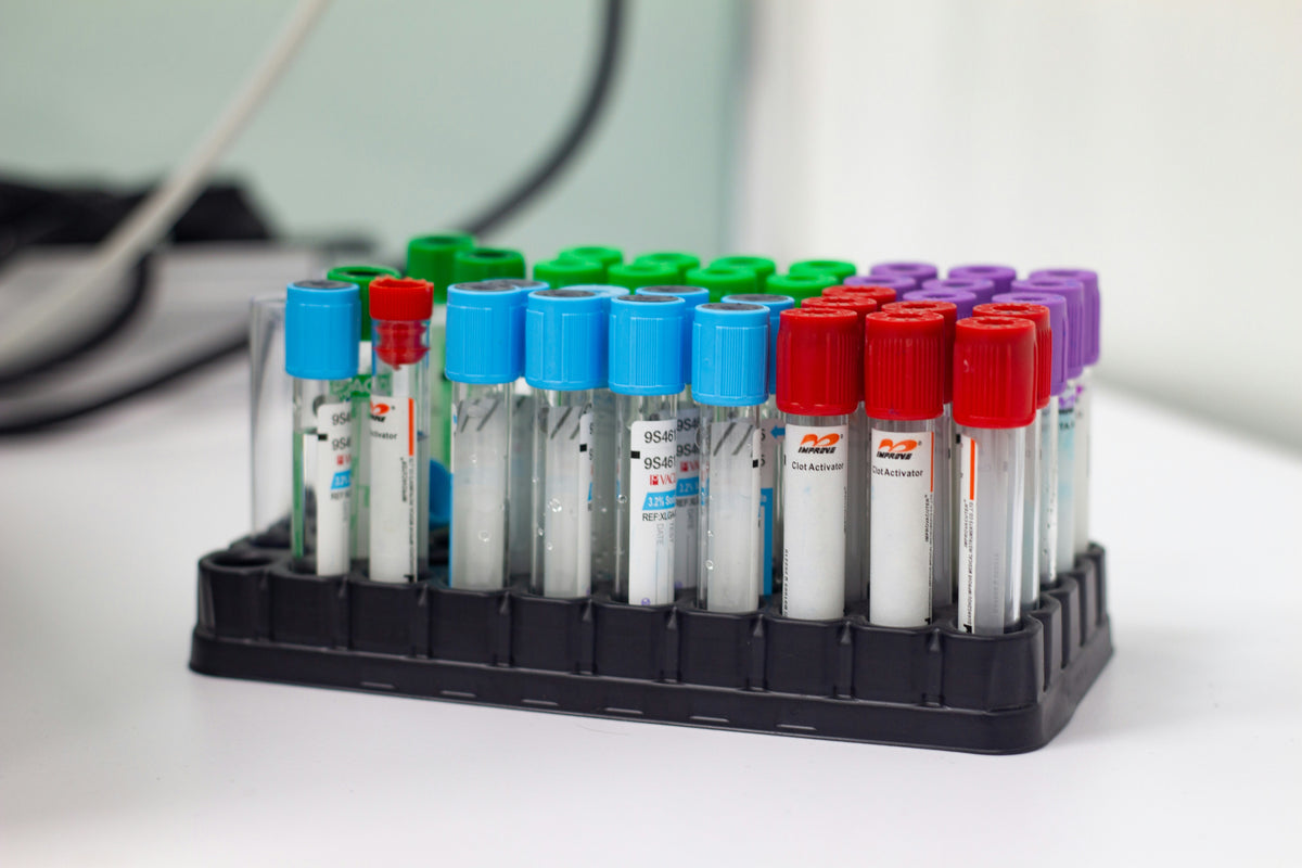 Test tubes with colored caps in a holder on a white surface | Labs Choice